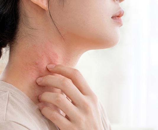 아토피·알레르기 진료 이미지